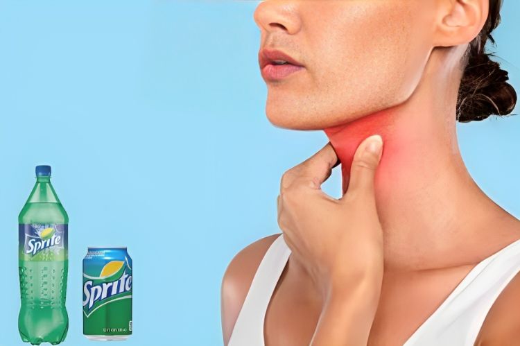 How Does Sprite Help With A Sore Throat?